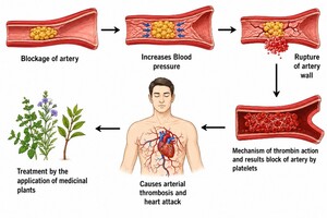 Figure from article: Therapeutic Potential of...
