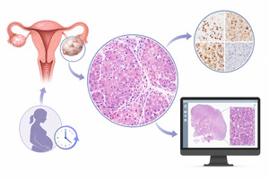 Figure from article: Ovarian Deciduosis...